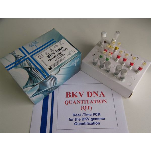 BKV DNA QUANTITATION (QT)
