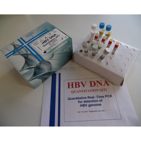 HBV DNA QUANTITATION (QT)