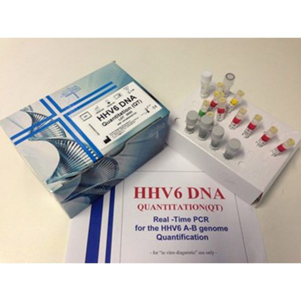 HHV6 DNA QUANTITATION (QT)