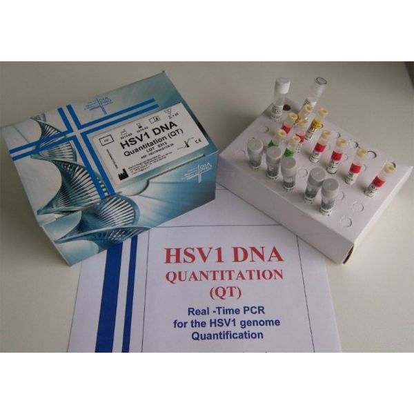 HSV1 DNA QUANTITATION (QT)